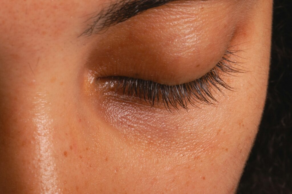 how much does blepharoplasty cost