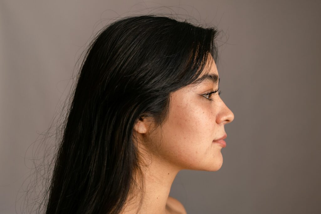 how long does rhinoplasty take to heal